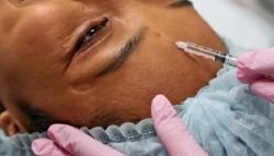 Justiça derruba regra que permitia a dentistas submeter pacientes a harmonização facial